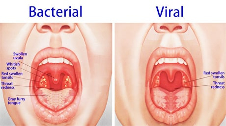 Low t symptoms in men